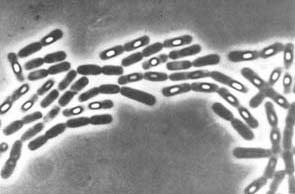 observación microscopica de bacilos esporulados